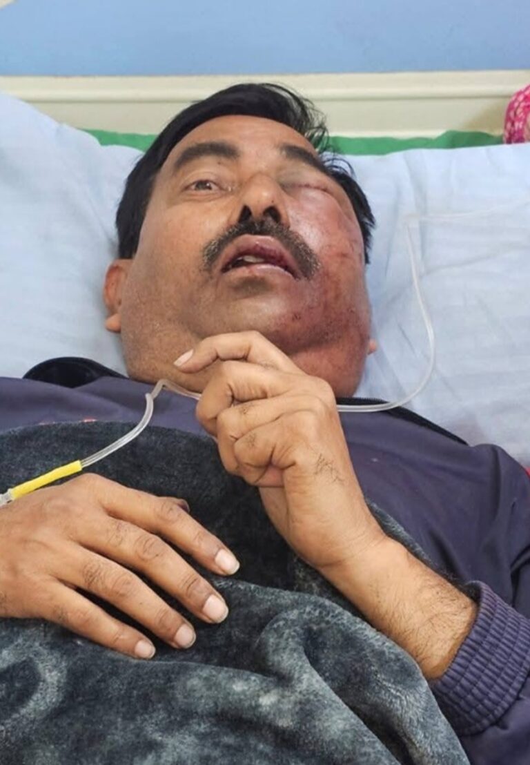 सुदर्शन न्यूज़ चैनल के लखनऊ संवाददाता पर जानलेवा हमला बुरी तरह से मारा गया