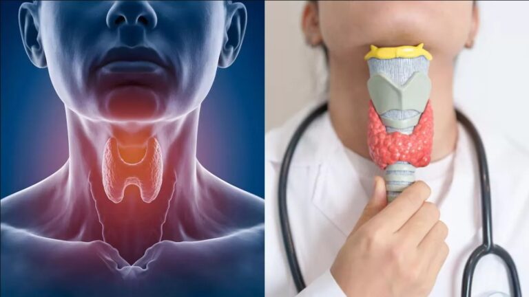 कुछ गलतियां बना सकती है थायरॉइड का मरीज,रखें इन बातों का ख्याल